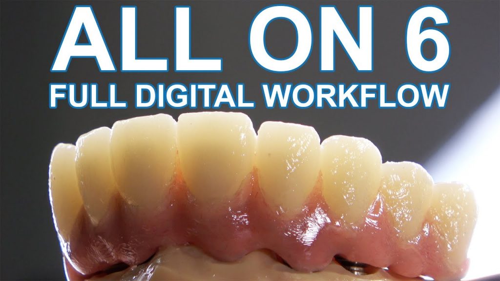 Thumbnail zum Video All on 6 - Full digital Workflow